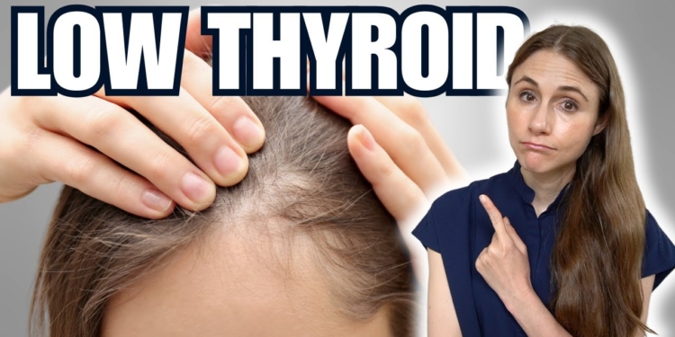 Why Your Thyroid Is Making Your Hair Fall Out
