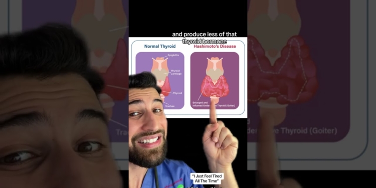 “I’m Just Tired All the Time” #why