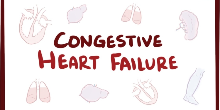An Osmosis Video: Congestive Heart Failure (CHF) Explained