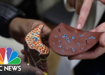 Unique program combines treatments for alcohol-related liver disease and addiction