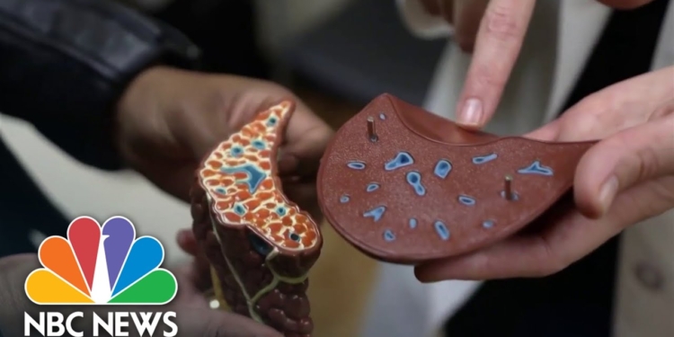 Unique program combines treatments for alcohol-related liver disease and addiction