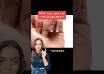 Signs of low thyroid with #pcos