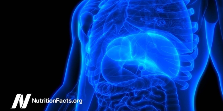 How to Prevent Non-Alcoholic Fatty Liver Disease