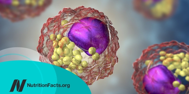 How Low Should You Go for Ideal LDL Cholesterol?