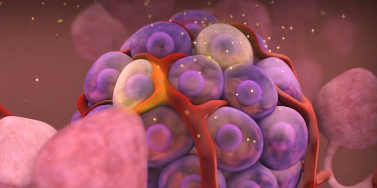 How diabetes destroys the human body
