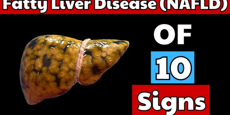 Fatty Liver Disease (NAFLD) OF 10 Signs | Early Symptoms Of Liver Disease