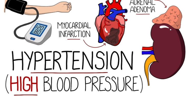Hypertension Explained (High Blood Pressure) - Includes Hypertensive Emergency & NICE Guidelines