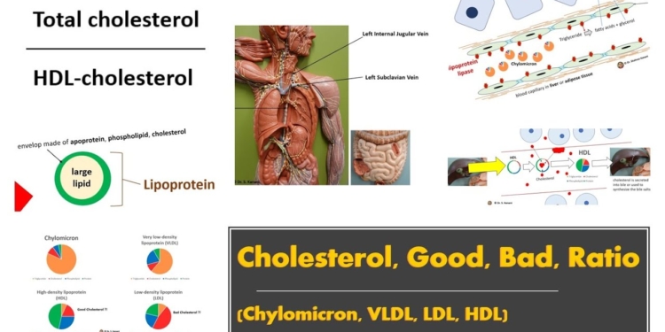 Cholesterol (Good, Bad, Ratio), Lipoproteins (Chylomicron, VLDL, LDL, HDL)