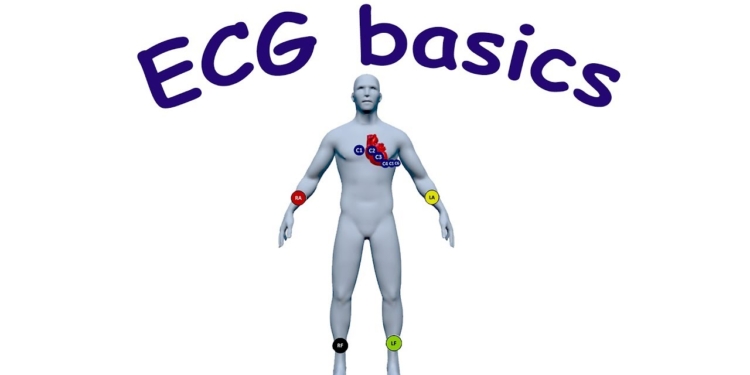 ECG basics