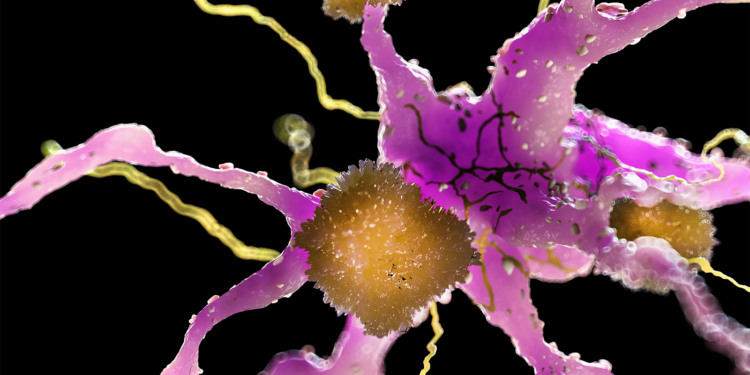 Alzheimer's Blood Tests: Most Patients Are Not Afraid to Know