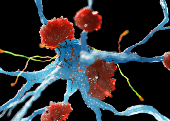 Alzheimer's Drug Review Ignites Backlash From Experts