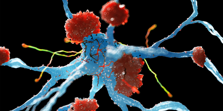 Alzheimer's Drug Review Ignites Backlash From Experts