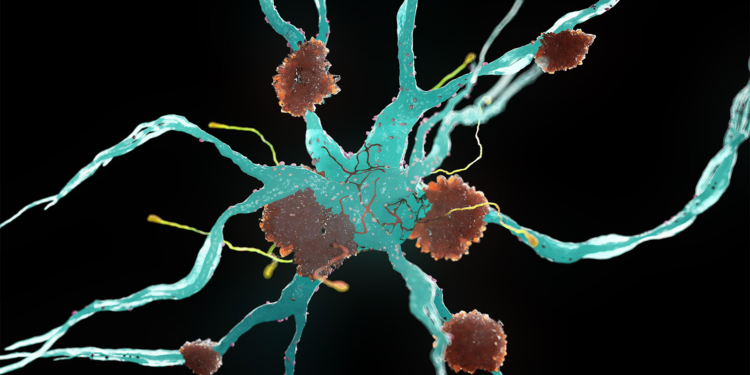 Alzheimer's Risk May Be Influenced by Flu Shots