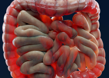 Are NSAIDs Genuinely Too Dangerous in Inflammatory Bowel Disease?