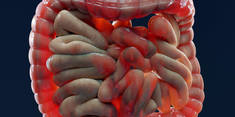 Are NSAIDs Genuinely Too Dangerous in Inflammatory Bowel Disease?