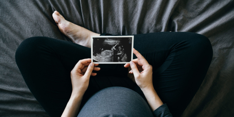 A high-angle photograph of a pregnant person sitting cross-legged on a bed and holds a sonogram of a baby.