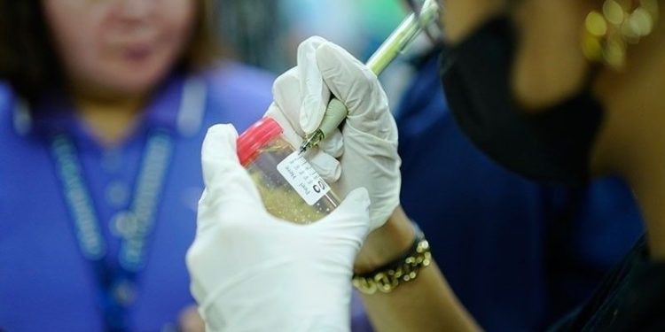 Barangay-based kidney health screening launched