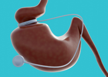 Call to Integrate Obesity Management With Surgery, GLP-1s Into Cancer Care