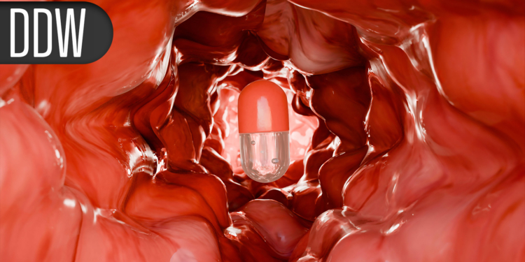 Can Endoscopic Procedure Slow Post-GLP-1 Weight Rebound?