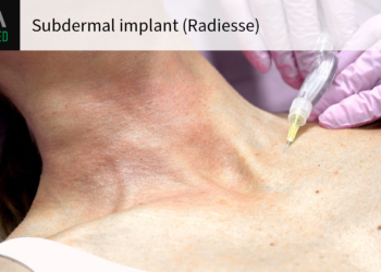 Despite Concerns Over Breast Screening, FDA OKs New Use for Dermal Filler