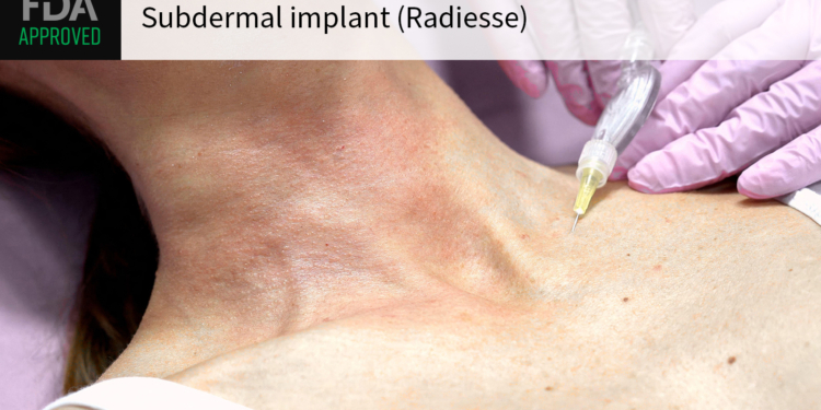 Despite Concerns Over Breast Screening, FDA OKs New Use for Dermal Filler