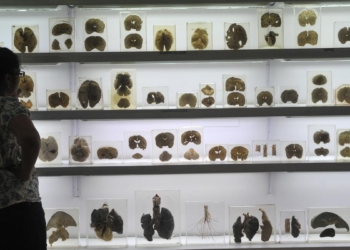 IISc’s Centre for Brain Research launches ₹2 crore AI challenge for early detection of cognitive decline