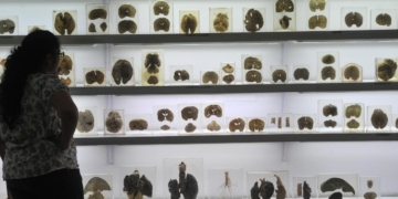 IISc’s Centre for Brain Research launches ₹2 crore AI challenge for early detection of cognitive decline