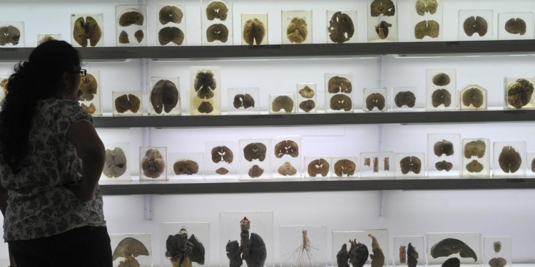 IISc’s Centre for Brain Research launches ₹2 crore AI challenge for early detection of cognitive decline