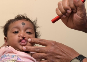 Improving cleft care in the age of AI