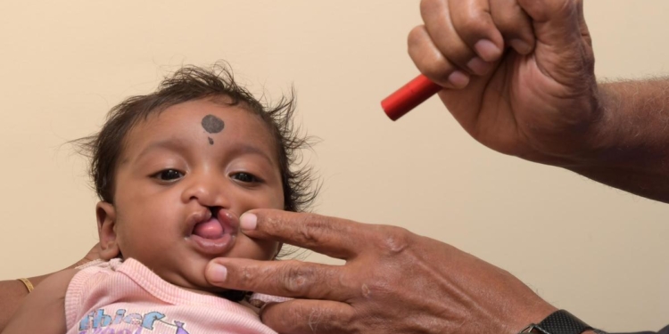 Improving cleft care in the age of AI