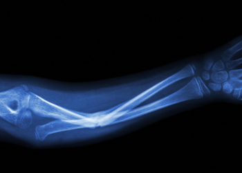 Large GLP-1 Drug Review Takes Closer Look at Risks, Rewards