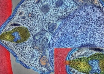 Malaria and the brain: understanding cerebral complications