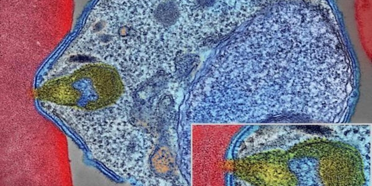 Malaria and the brain: understanding cerebral complications