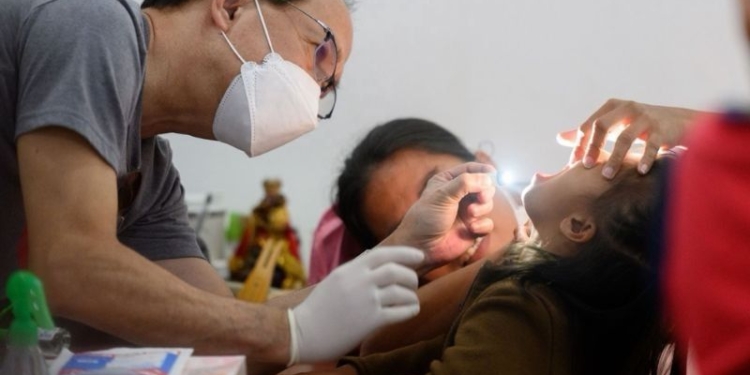 Masbate children get free cleft, palate surgeries