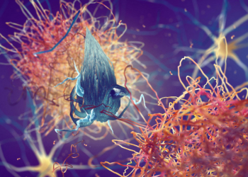 Midlife Vitamin D Levels Tied to Alzheimer's-Related Brain Changes