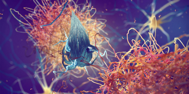 Midlife Vitamin D Levels Tied to Alzheimer's-Related Brain Changes