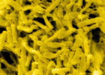 Multiple Drugs Flagged for Higher C. Diff Risk