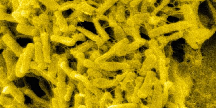 Multiple Drugs Flagged for Higher C. Diff Risk