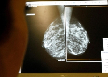 Nearly 13% of women in India with breast cancer experienced metastasis: Study