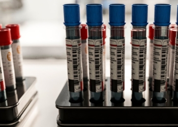 Patients say they want Alzheimer’s blood tests. Doctors aren’t sure they help.