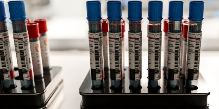 Patients say they want Alzheimer’s blood tests. Doctors aren’t sure they help.