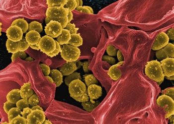 Study unravels why men experience more skin infections than women