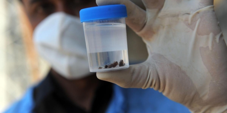 Teenager becomes first Congo virus fatality in Pakistan's Karachi