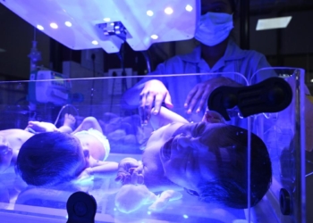 Umbilical cord blood may hold clues for a child’s risk of developing Type 1 diabetes