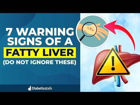 7 Warning Signs of a Fatty Liver (Do not ignore these!)