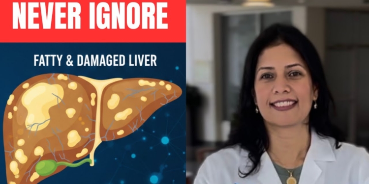 8 Warning Signs for Fatty Liver: Weight Loss Doctor Explains