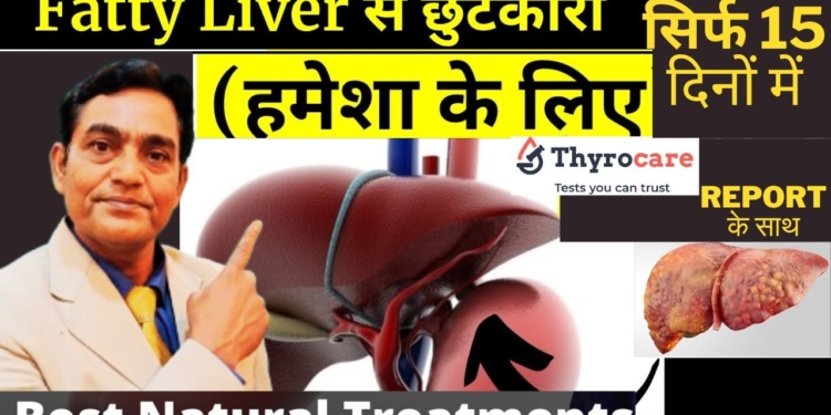 सिर्फ 1 चीज खाके अपने फैटी लिवर को 15 दिन मे ठीक किया । सबूत आपके सामने । #fattylivertreatment