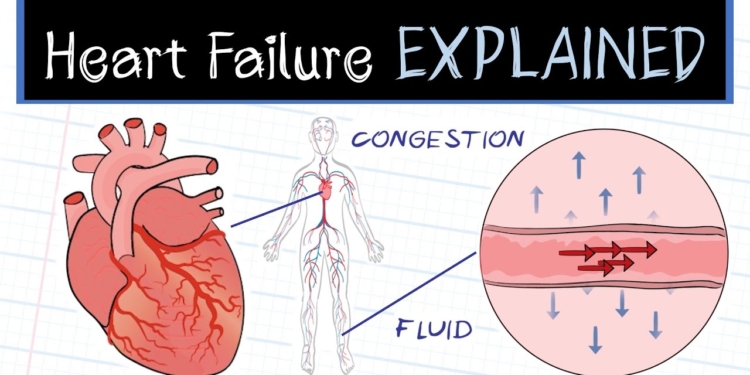 What is Heart Failure?