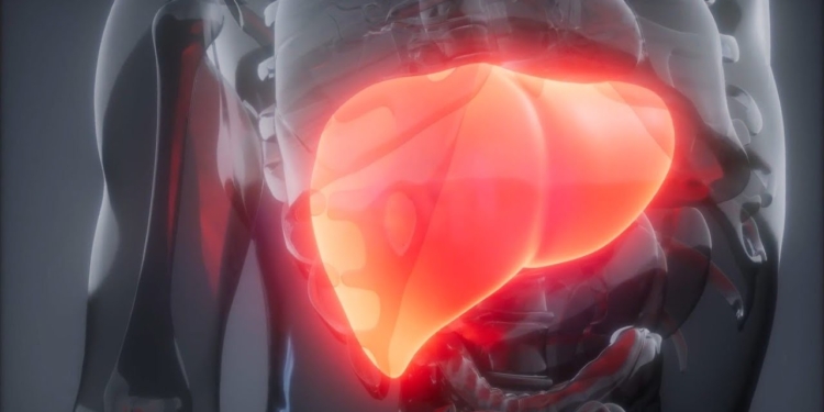 Hundreds call to get scanned for fatty liver disease after KSAT story airs