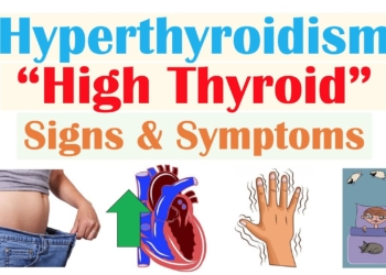 Hyperthyroidism & Thyroid Storm Signs & Symptoms (& Why They Occur)
